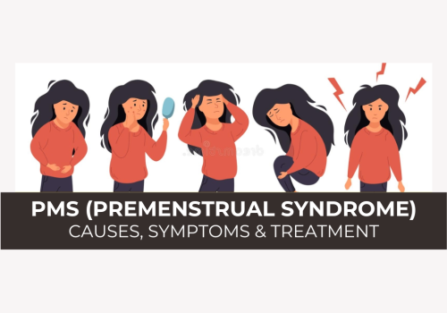 Premenstrual Syndrome (PMS) Causes, Symptoms, and Treatment